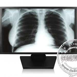 GENEVISION High Definition Smpte296m Medical Lcd Monitor Display Quick Response Time (MSDI-200)