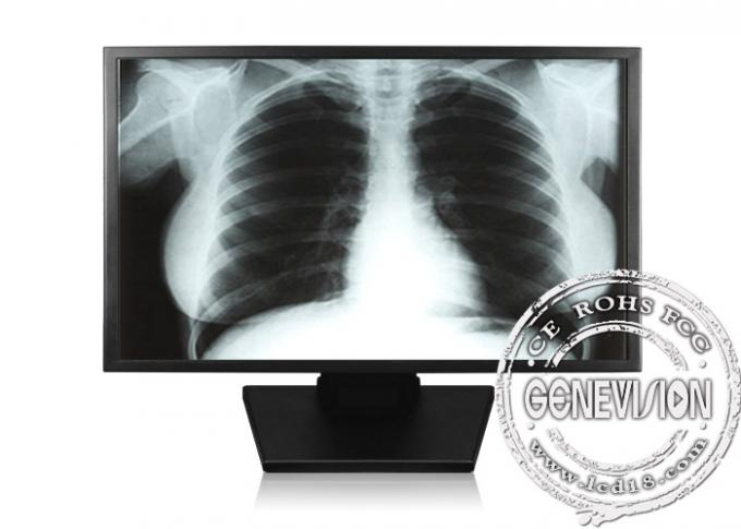 GENEVISION High Definition Smpte296m Medical Lcd Monitor Display Quick Response Time (MSDI-200)